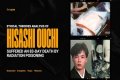 The Devastating Aftermath: Hisashi Ouchi's Autopsy Reveals Extent Of Radiation Damage